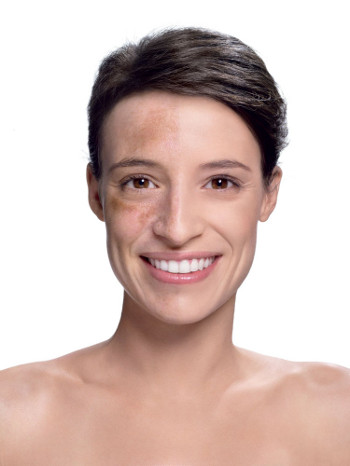 Vichy Dermablend Corrective Foundation model. Boots. Before and after